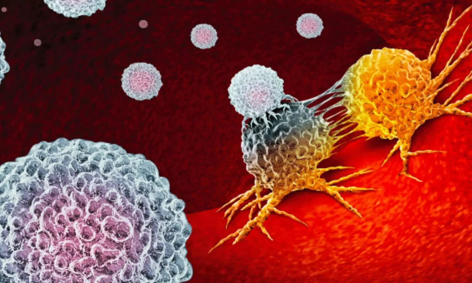 India Introduces 7-Minute Immunotherapy Shot for Lung Cancer Patients