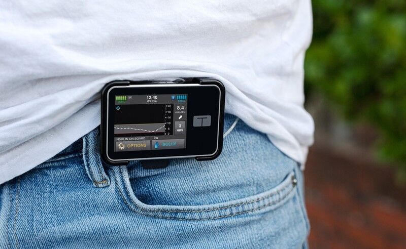 Use of ultra-fast acting insulin With smart insulin pump system Improves Glucose Control in Type 1 Diabetes: Study