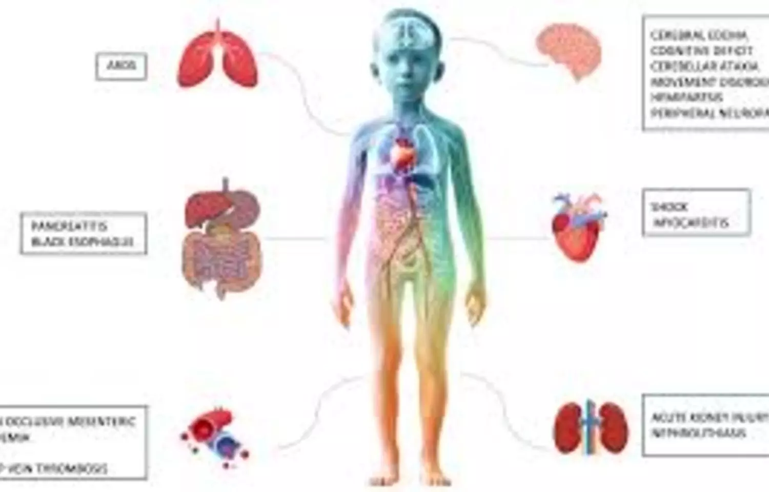 High Blood Glucose, Infection, and New-Onset Diabetes Delay DKA Resolution in Children: Study High Blood Glucose, Infection, and New-Onset Diabetes Delay DKA Resolution in Children: Study