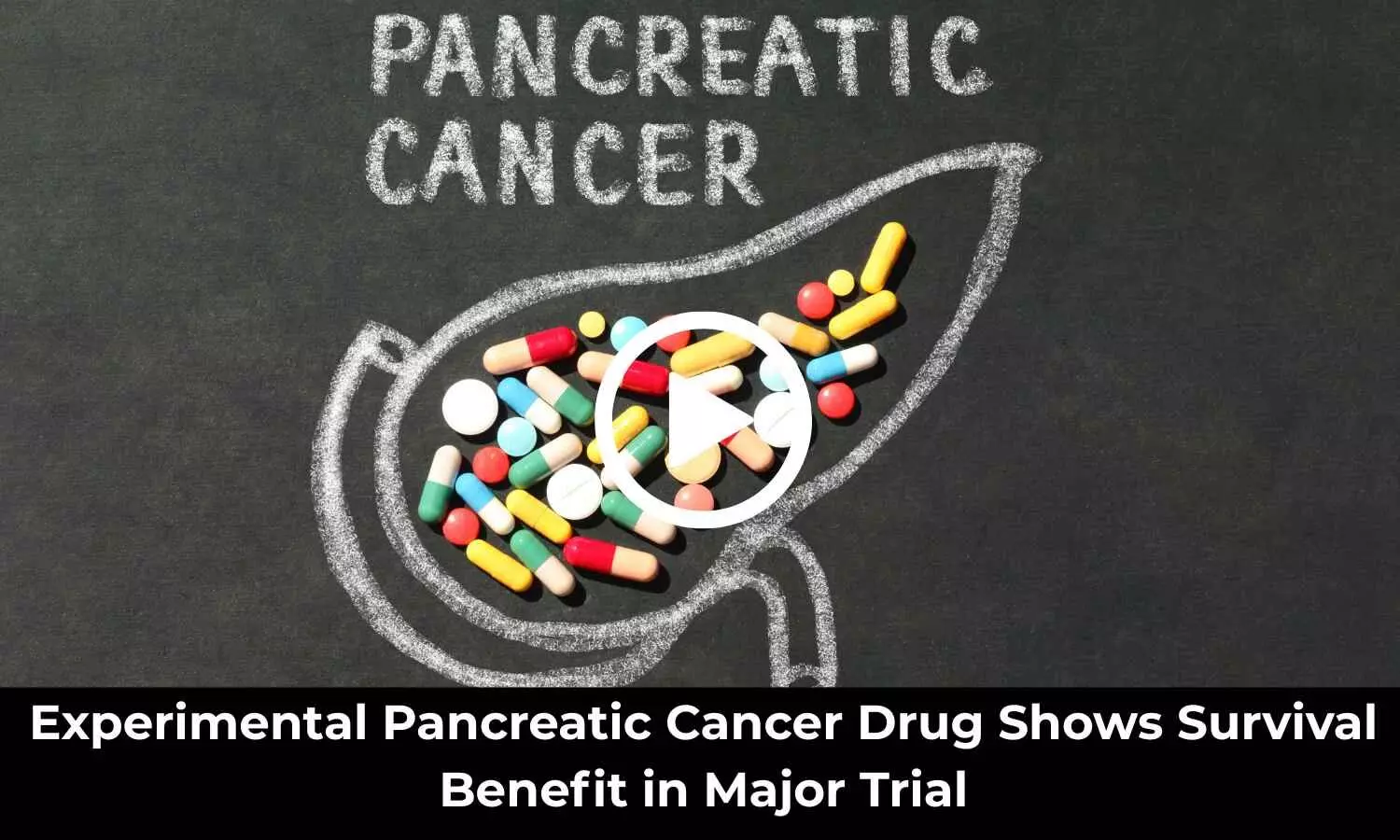 Experimental Pancreatic Cancer Drug Shows Survival Benefit in Major Trial