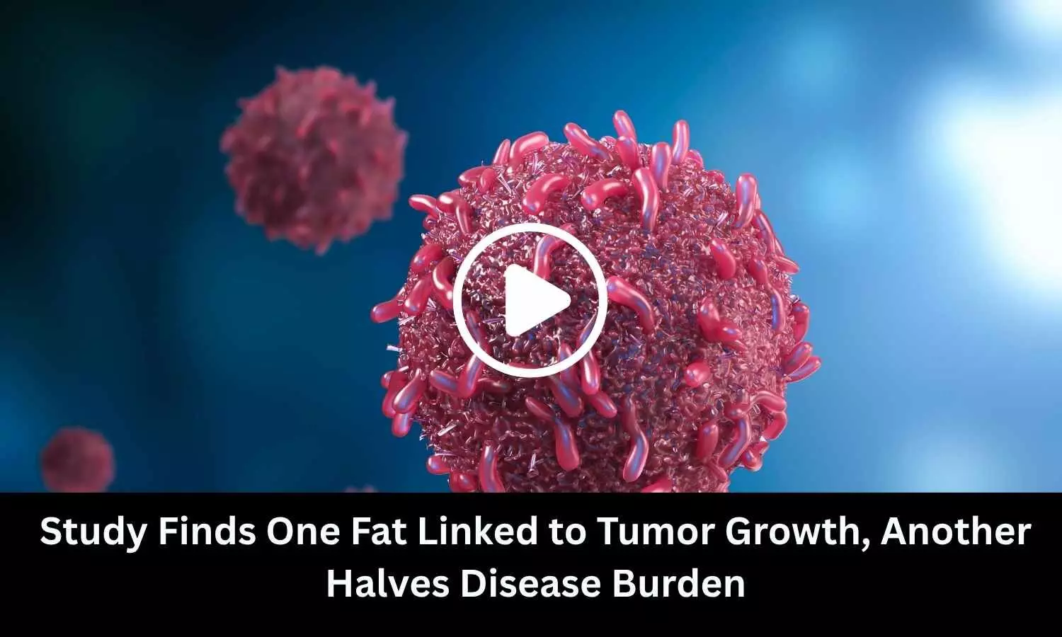 Study Finds One Fat Linked to Tumor Growth, Another Halves Disease Burden