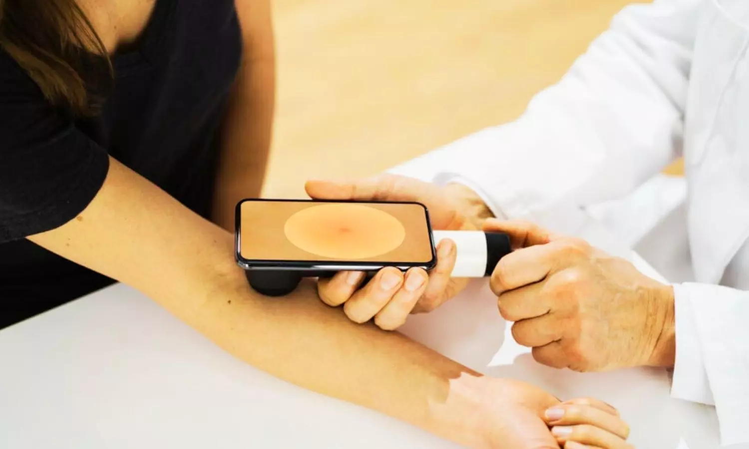 AI Matches Mid-Level Clinicians in Skin Lesion Diagnosis in Realistic Settings, Finds JAMA study