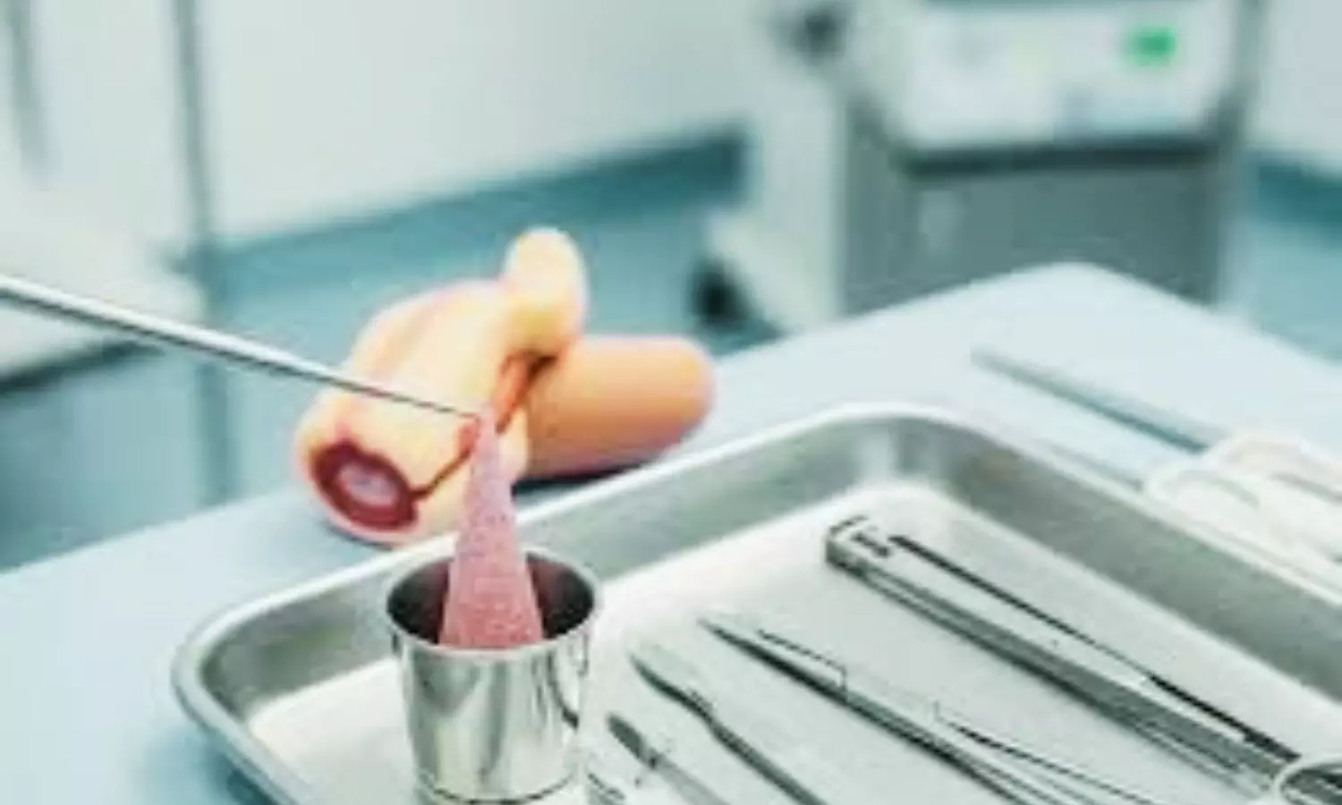 Cold Knife Conization Outperforms LEEP for Cervical Precancerous Lesions: JAMA
