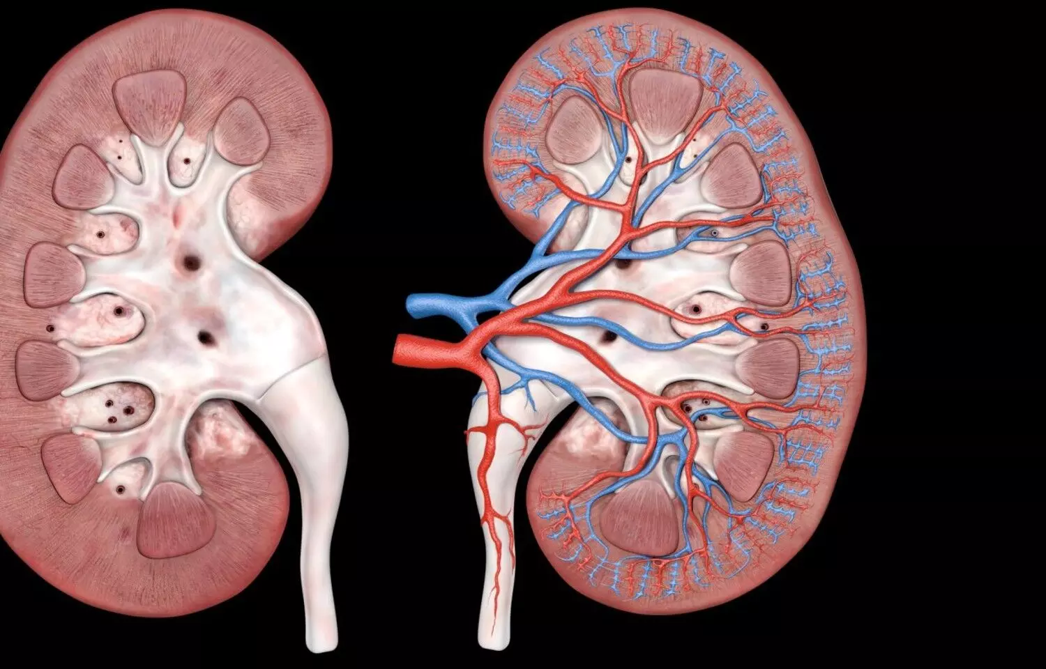 Probiotics Show Potential Benefits in Diabetic Kidney Disease: Study