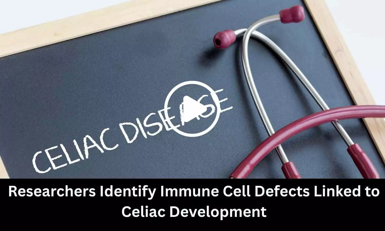 Researchers Identify Immune Cell Defects Linked to Celiac Development