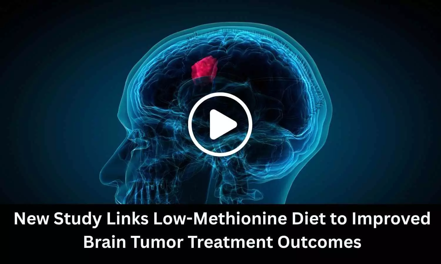 New Study Links Low-Methionine Diet to Improved Brain Tumor Treatment Outcomes New Study Links Low-Methionine Diet to Improved Brain Tumor Treatment Outcomes