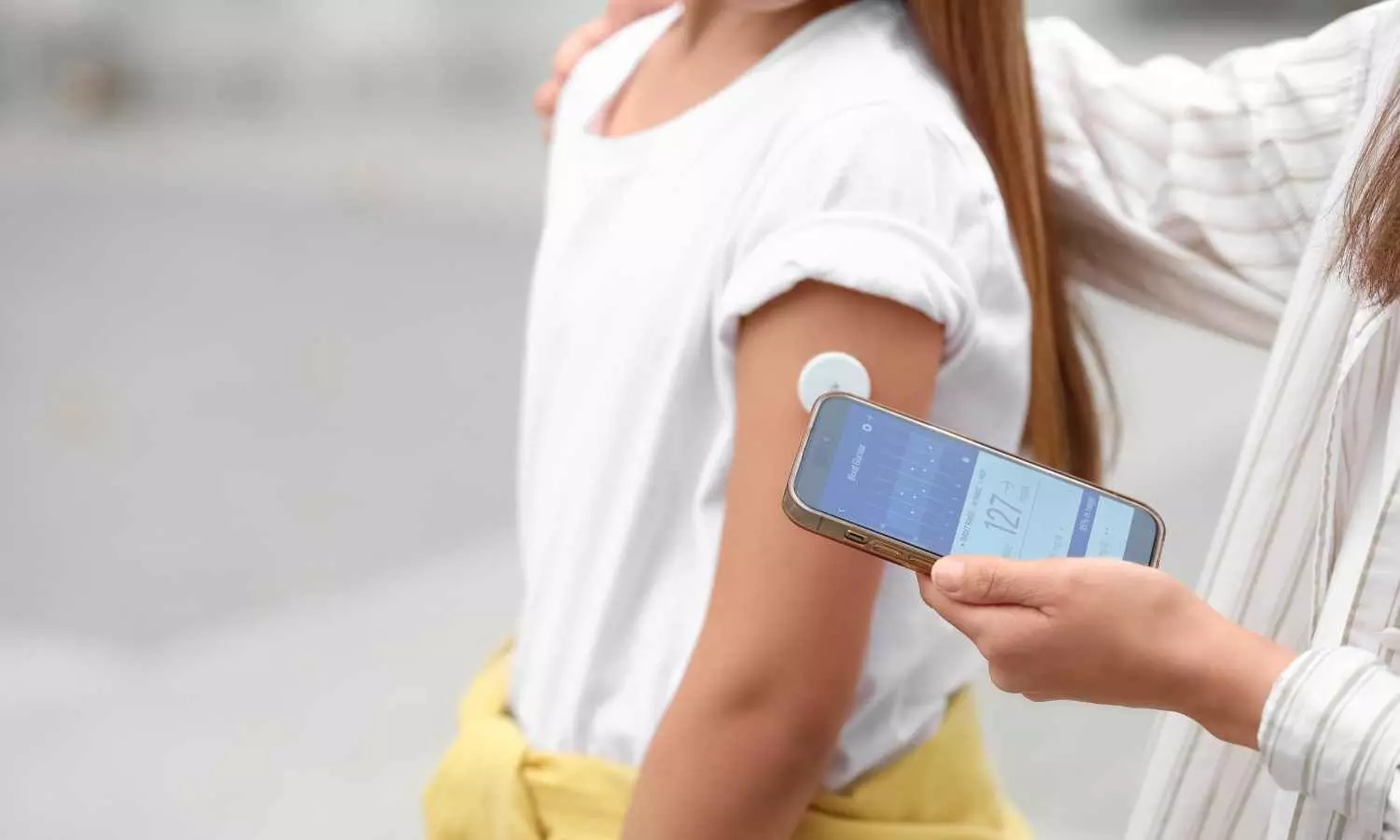 FDA Clears First OTC Continuous Glucose Monitor for Children
