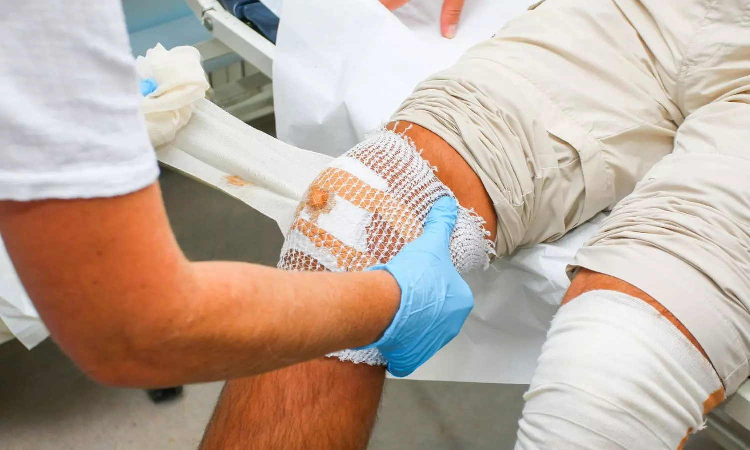 Centres of Excellence to address diabetes-linked wounds Centres of Excellence to address diabetes-linked wounds