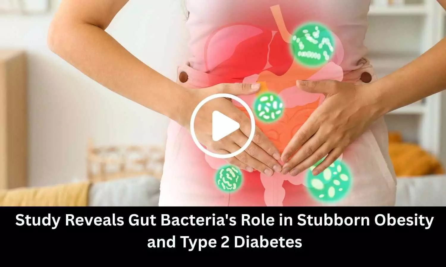 Study Reveals Gut Bacterias Role in Stubborn Obesity and Type 2 Diabetes