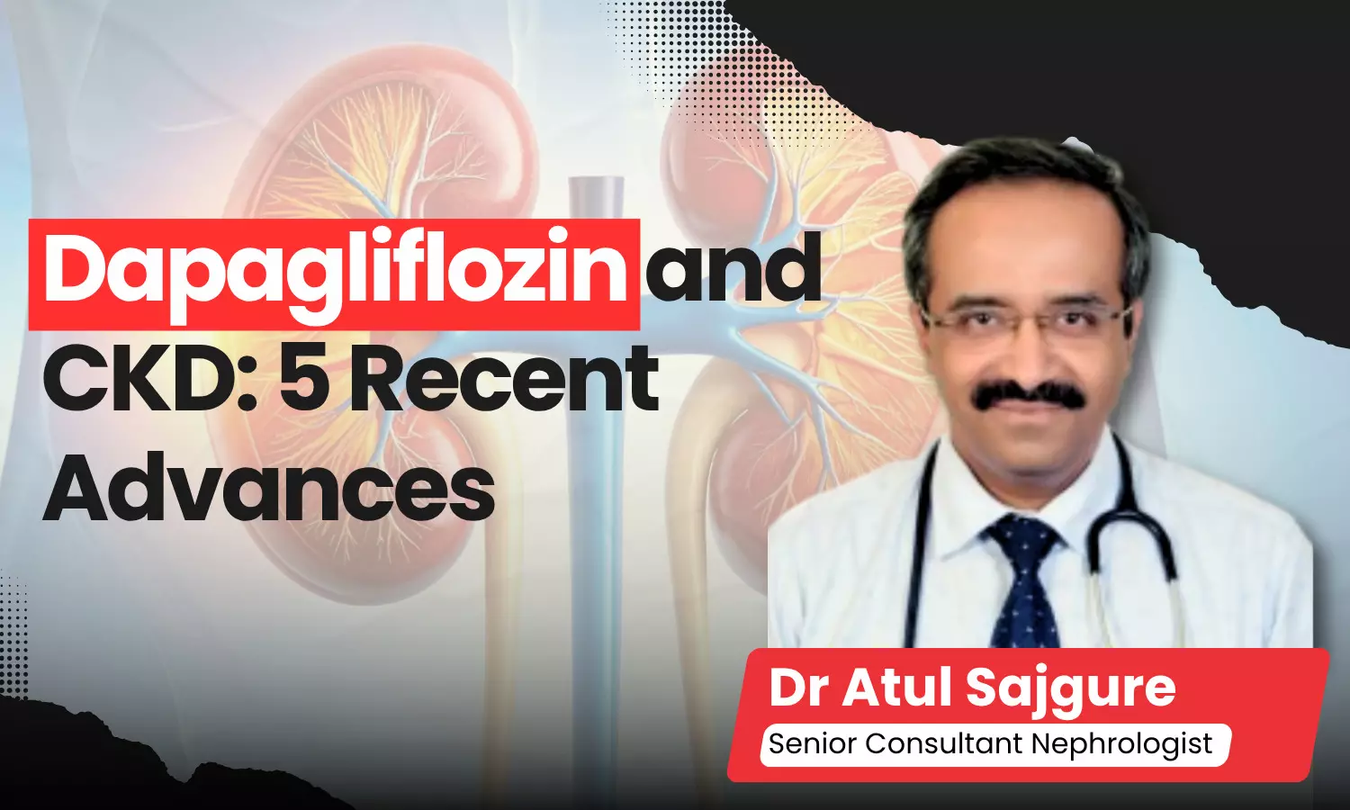 Dapagliflozin & Kidney: Top 5 New Evidence Highlights in 2026