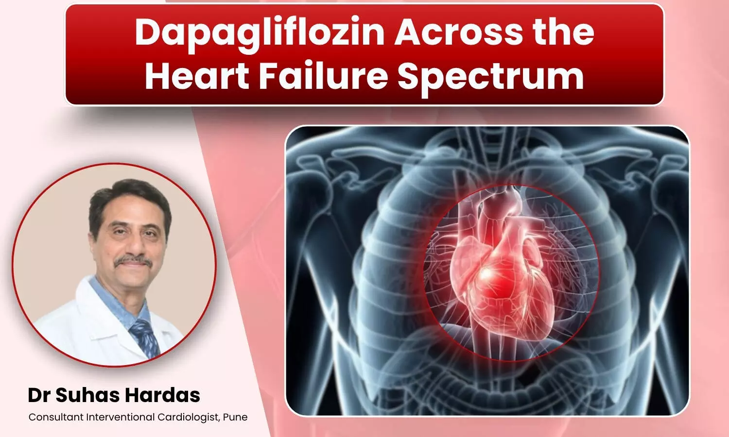 Dapagliflozin in Heart Failure: Cardiologists Practical Perspective