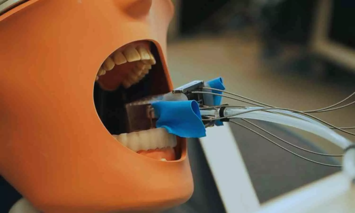 A mini robot may simplify dental treatment, suggests research A mini robot may simplify dental treatment, suggests research