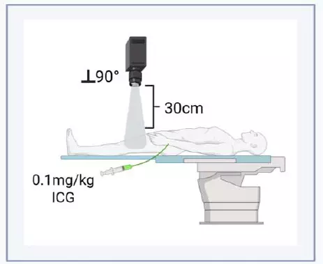 Near-Infrared Fluorescence Imaging Shows Promise for Real-Time Bone Perfusion Assessment in Fracture Non-Union Surgery: Study Near-Infrared Fluorescence Imaging Shows Promise for Real-Time Bone Perfusion Assessment in Fracture Non-Union Surgery: Study