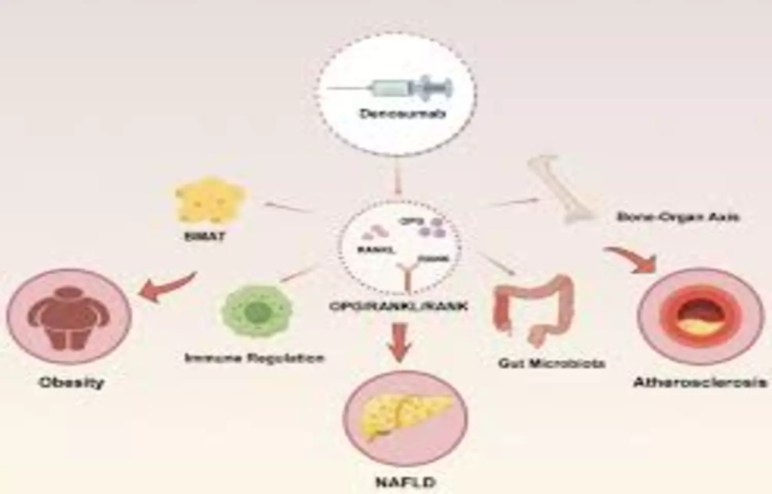 Single-Dose Denosumab Does Not Alter Glucose or Lipid Metabolism: Study Single-Dose Denosumab Does Not Alter Glucose or Lipid Metabolism: Study