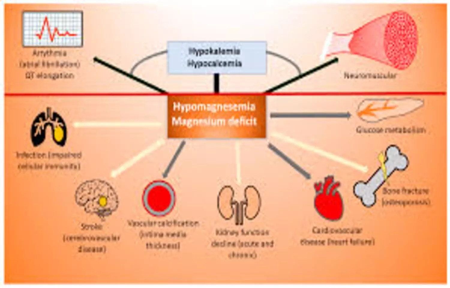 Recurrent Hypomagnesemia Associated With Increased Risk of Dementia: Study Recurrent Hypomagnesemia Associated With Increased Risk of Dementia: Study