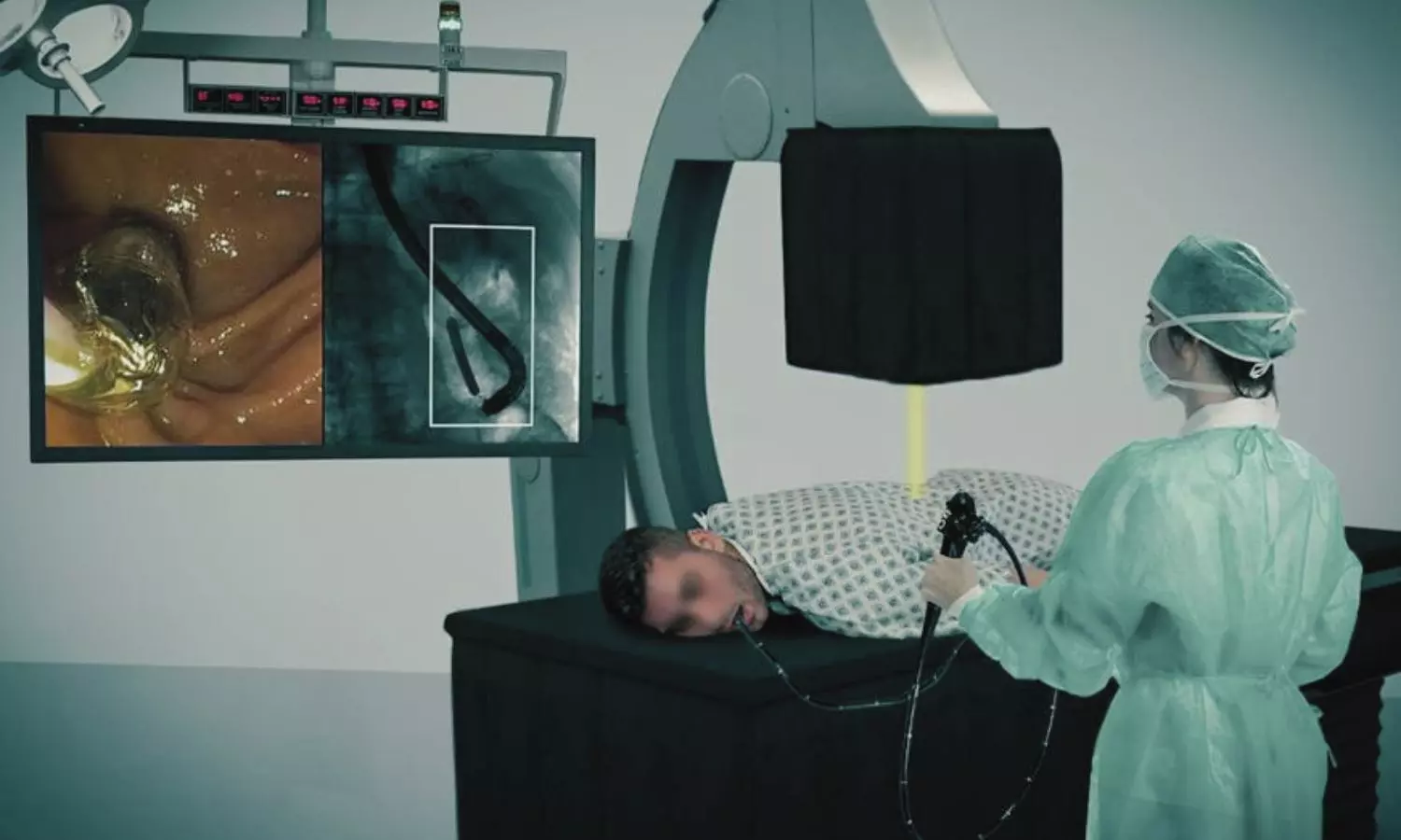 AI-Enabled Fluoroscopy System May Reduce Radiation Exposure to Endoscopy Staff: Study AI-Enabled Fluoroscopy System May Reduce Radiation Exposure to Endoscopy Staff: Study