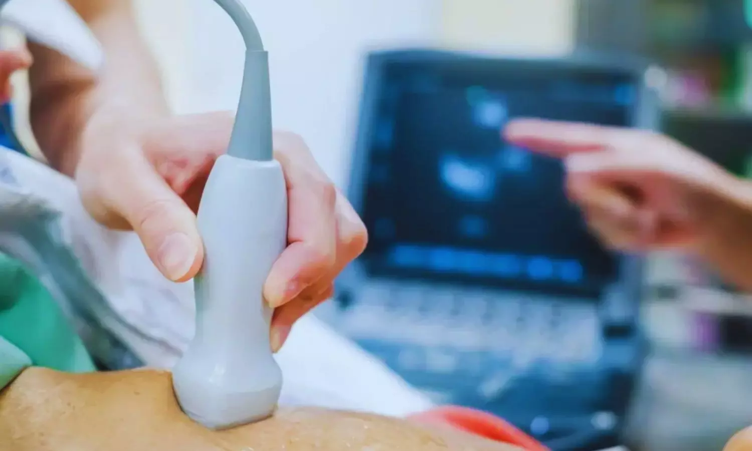 Perioperative Diaphragmatic Ultrasound Reliable for Guiding Extubation and Reducing Pulmonary Complications: Study Perioperative Diaphragmatic Ultrasound Reliable for Guiding Extubation and Reducing Pulmonary Complications: Study
