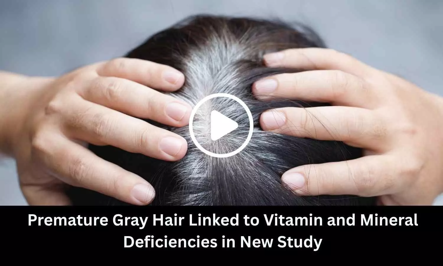 Premature Gray Hair Linked to Vitamin and Mineral Deficiencies in New Study