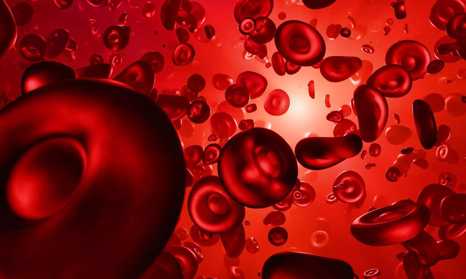 Link Between Iron Overload and Systemic Toxicity in Transfusion-Dependent Thalassemia, Suggests Study