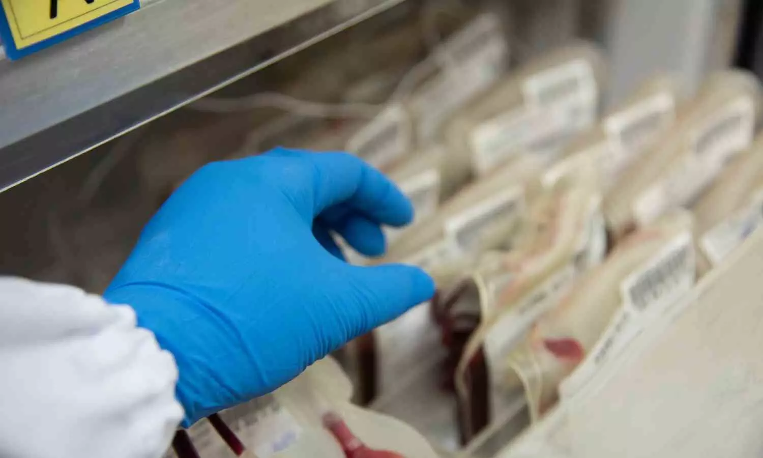 FIR Against Two Former Contract Staff Over Alleged Misuse of Government Blood Bags FIR Against Two Former Contract Staff Over Alleged Misuse of Government Blood Bags