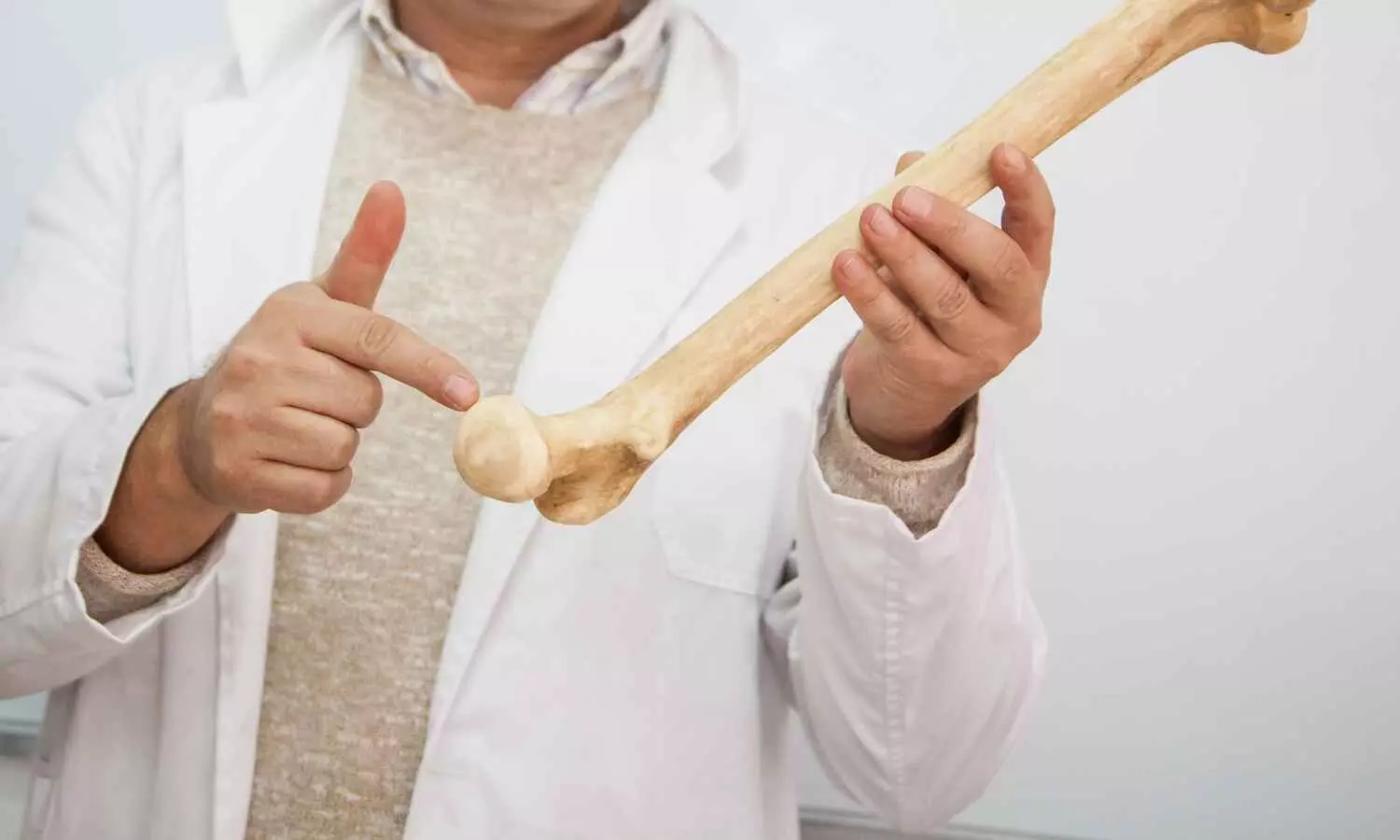 Near-Infrared Fluorescence Imaging feasible method for intraoperative bone perfusion assessment in fracture non-union: study Near-Infrared Fluorescence Imaging feasible method for intraoperative bone perfusion assessment in fracture non-union: study