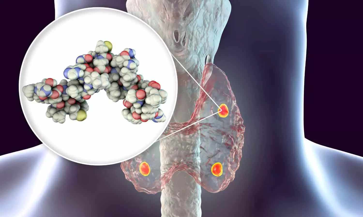 New Rapid Test Replaces Frozen Sections in Parathyroid Surgery, Suggests Study