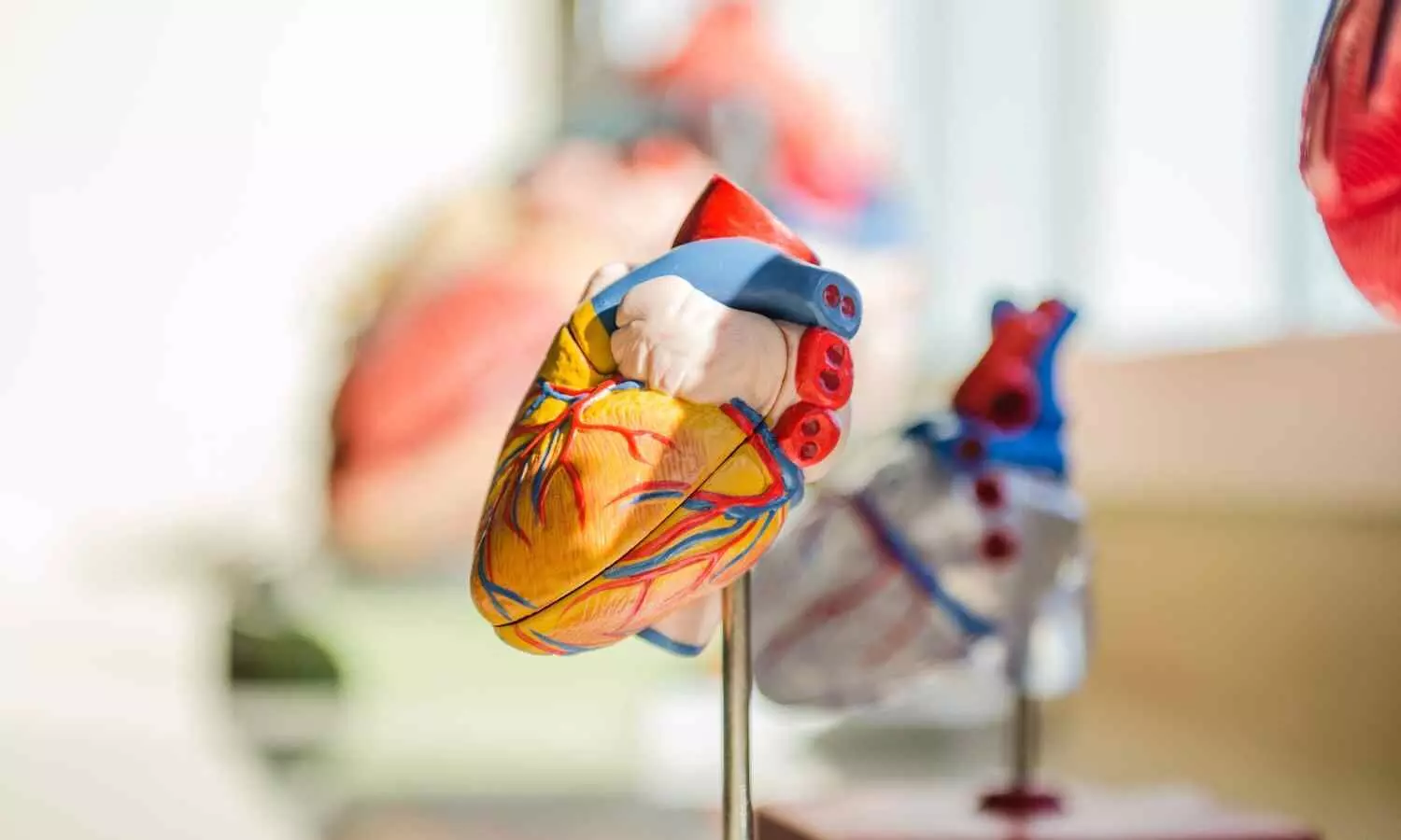 Bacteria from gum disease may cause inflammation, harden heart valves, reveals research Bacteria from gum disease may cause inflammation, harden heart valves, reveals research