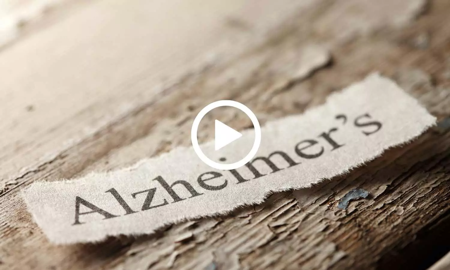 Researchers Uncover Surprising Memory Role of Alzheimers Tau Protein