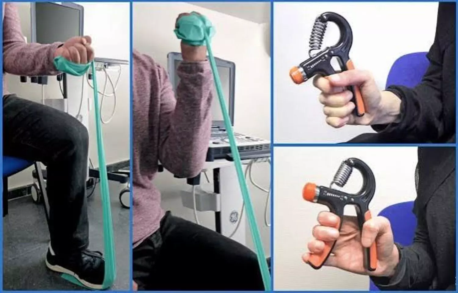 Preoperative Isometric Exercise Improves Vein Size and AV Fistula Creation Success before dialysis: Study