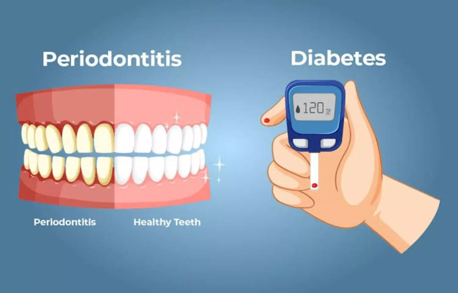 Higher HbA1c Levels Linked to Increased Risk of Periodontitis: Study Higher HbA1c Levels Linked to Increased Risk of Periodontitis: Study