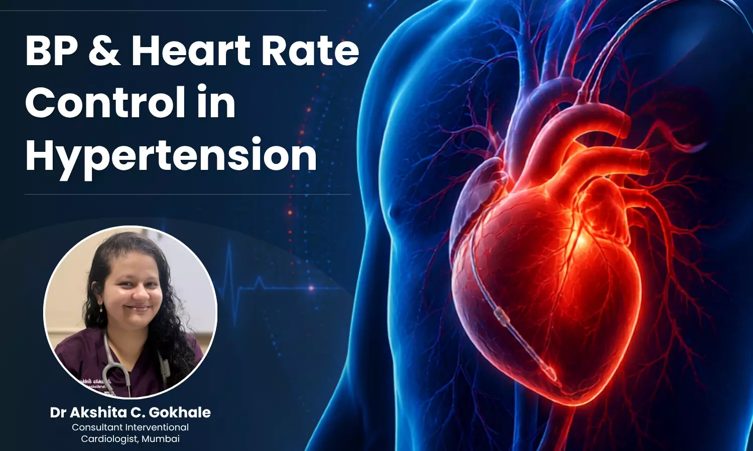 Is Heart Rate the Missing Target in Hypertension Management?