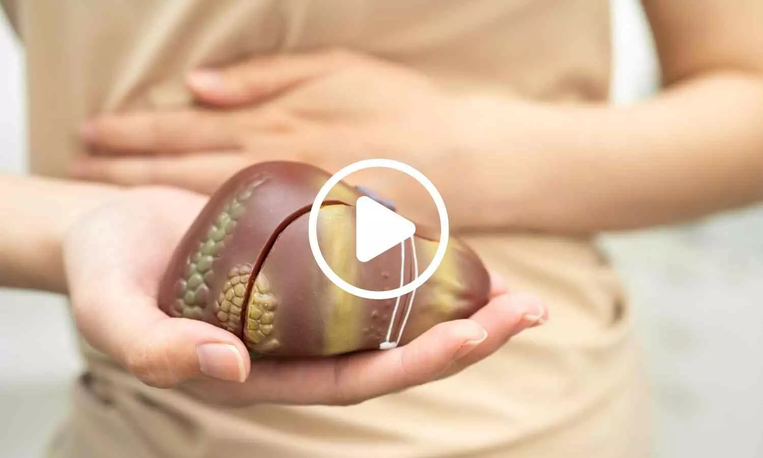 Researchers Develop Experimental Drug That Reverses Severe Fatty Liver Disease Researchers Develop Experimental Drug That Reverses Severe Fatty Liver Disease