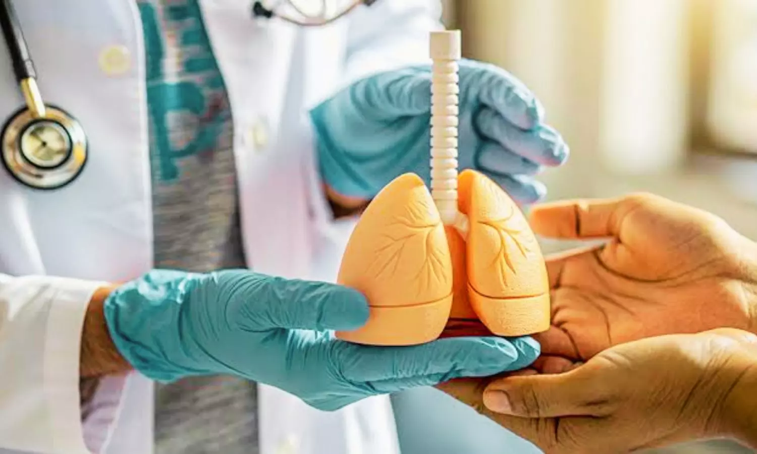 Higher HDL-C Levels Before Lung Transplant Linked to Better Outcomes in Women: Study Higher HDL-C Levels Before Lung Transplant Linked to Better Outcomes in Women: Study