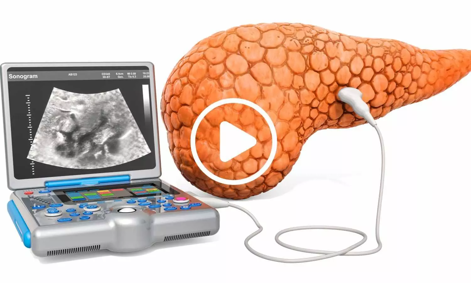 Study Suggests Early Electroacupuncture Helps Preserve Pancreatic Function in Prediabetes Study Suggests Early Electroacupuncture Helps Preserve Pancreatic Function in Prediabetes