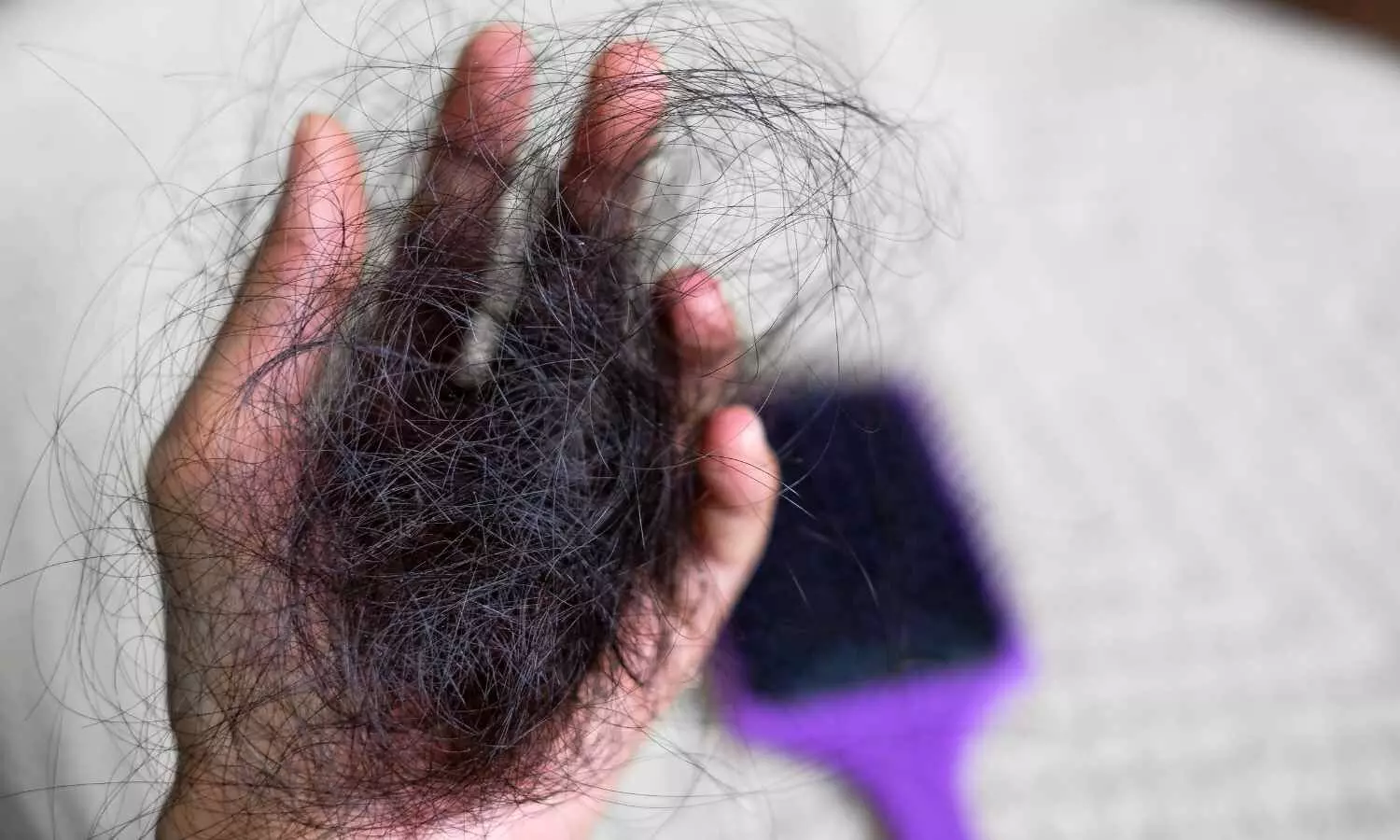 GLP-1 diabetes drugs linked to increased risk of hair loss, finds study GLP-1 diabetes drugs linked to increased risk of hair loss, finds study