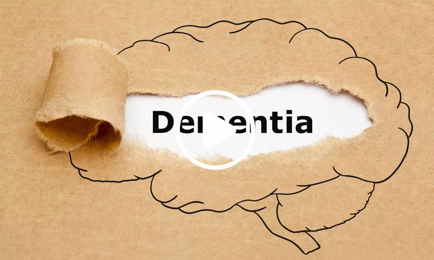 Spouses May Raise Dementia Risk by Up to 70 Percent: Study Spouses May Raise Dementia Risk by Up to 70 Percent: Study