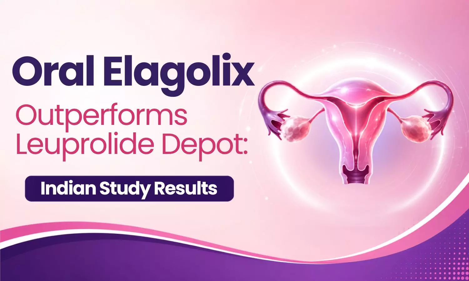 Oral Elagolix Achieves Greater Endometrioma Size Reduction and a Three-Fold Higher Conception Rate Compared to Leuprolide Depot: Indian Study