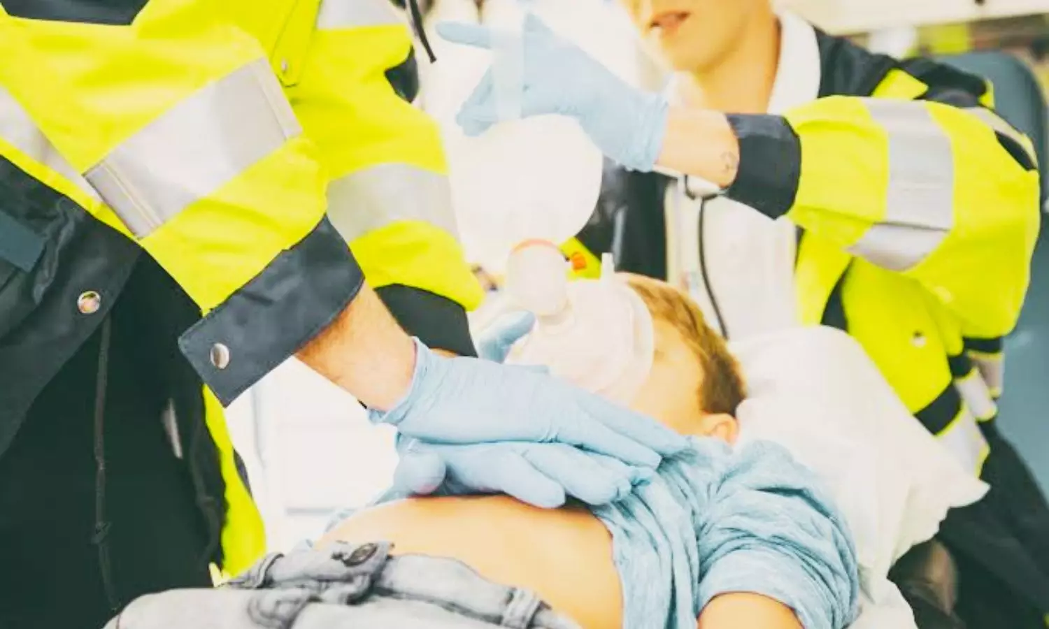 Early Automated External Defibrillator Pad Application Improves Outcomes After Pediatric Cardiac Arrest: JAMA