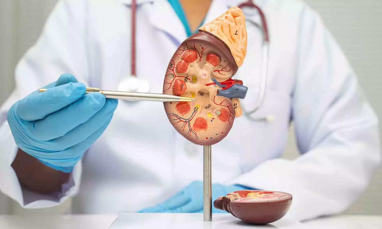 Hydronephrosis Grade Drives Emergency Treatment Choices in Pregnant Patients, Data Reveal