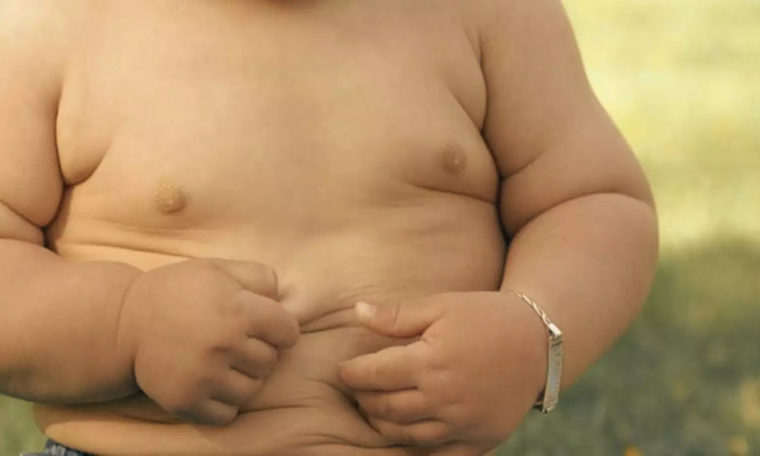 Add-on Family-Based Behavioral Therapy to ESOC Improves Childhood Obesity Outcomes: JAMA