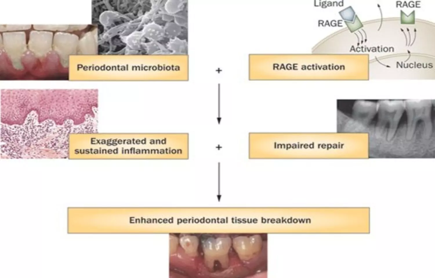 Periodontitis and Uncontrolled Diabetes May Disrupt Mineral Balance, Suggests Study Periodontitis and Uncontrolled Diabetes May Disrupt Mineral Balance, Suggests Study
