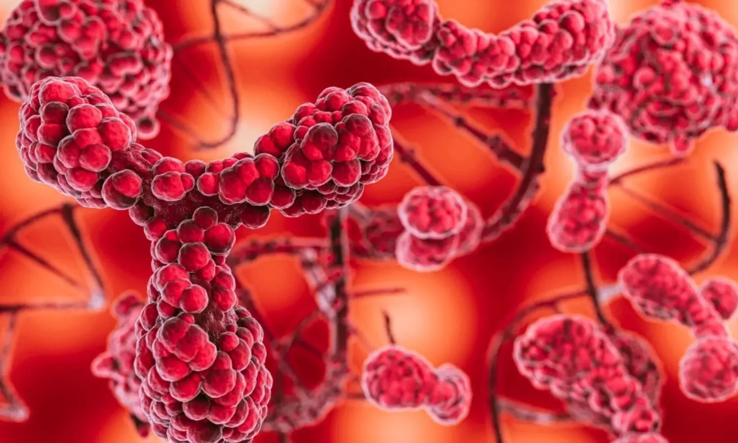 Amyloidosis Presents Earlier in India Than in Western Countries, Systematic Review Finds