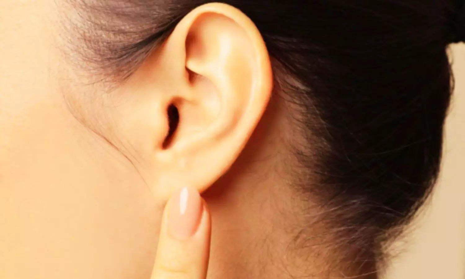 Turkey Ear Reported 20 Years After Earlobe Piercing in Rare Cutaneous Tuberculosis Case
