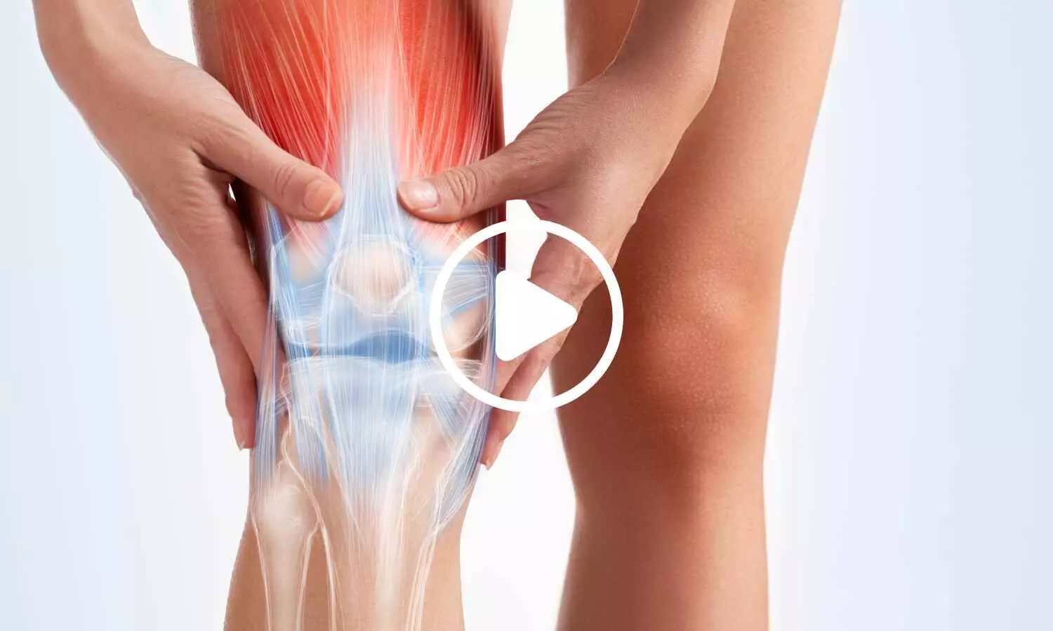 Daily Fiber Supplement Reduced Knee Arthritis Pain and Improved Muscle Strength, Study Finds Daily Fiber Supplement Reduced Knee Arthritis Pain and Improved Muscle Strength, Study Finds