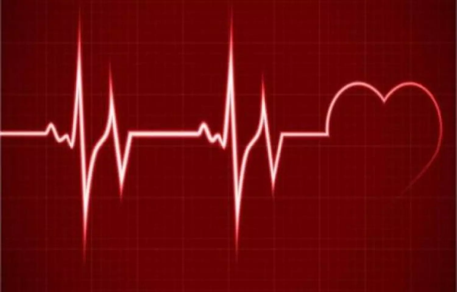 Low HCQS levels Linked to Higher ASCVD Risk in SLE: Study Low HCQS levels Linked to Higher ASCVD Risk in SLE: Study