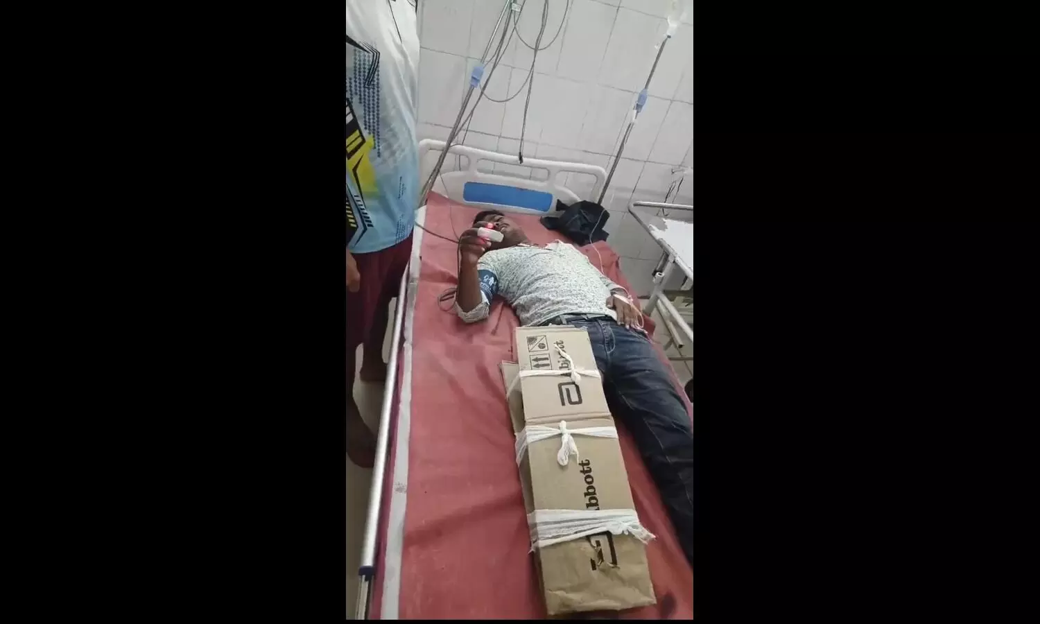 Fractured leg Fractured leg
