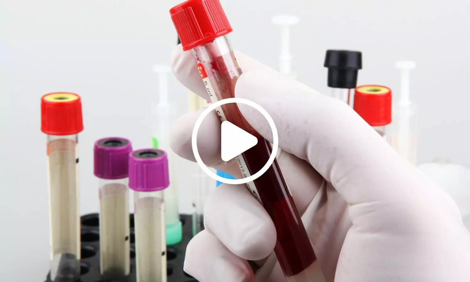 New Research Reveals Blood Test That Could Identify Multiple Cancers Early