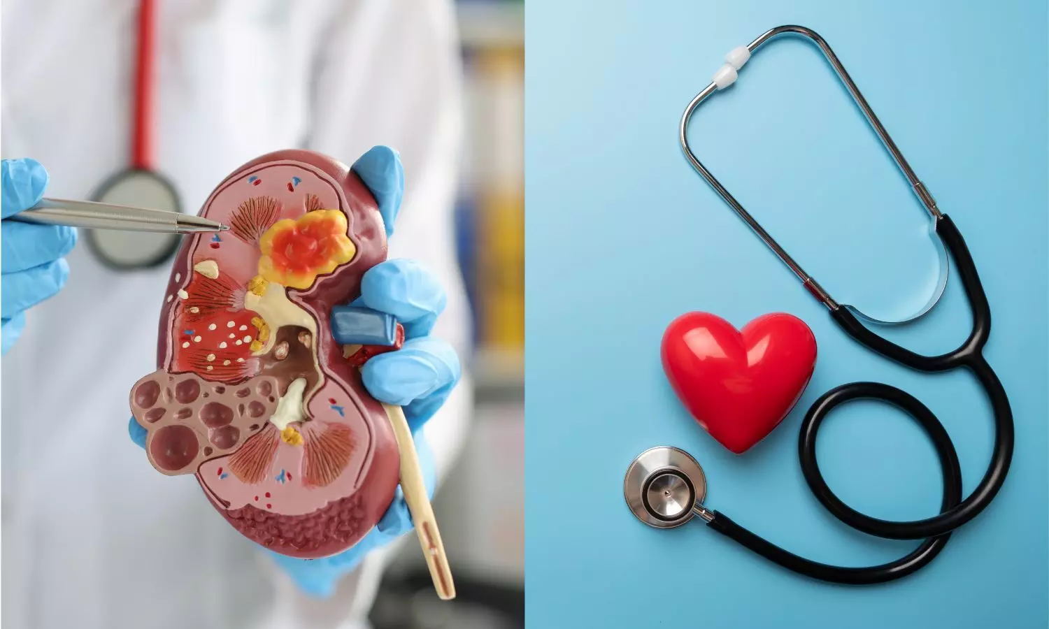 Sacubitril/Valsartan Plus Ivabradine Improves Outcomes in CRS Patients: Study