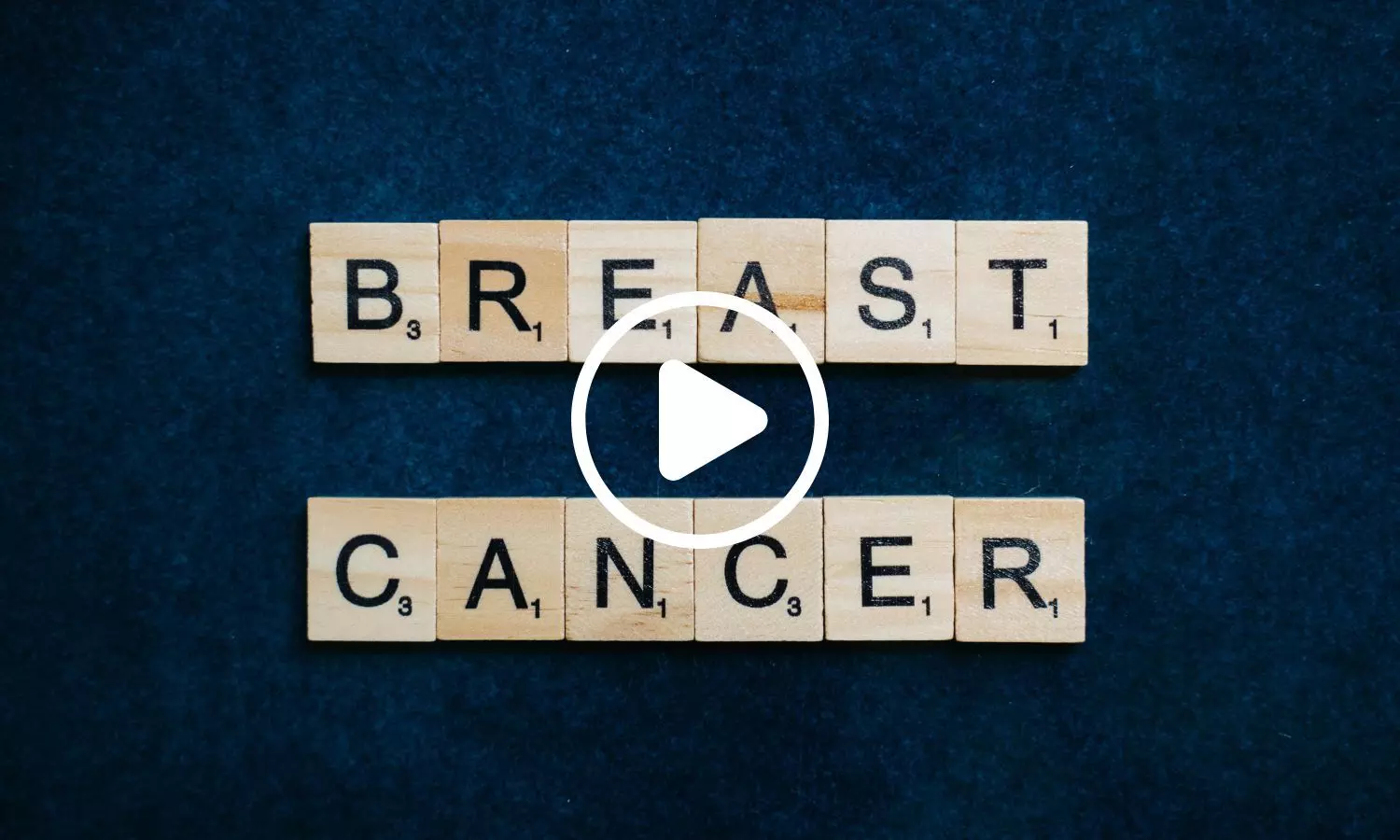 Researchers Discover Nerve Network That Could Promote Breast Cancer Progression Researchers Discover Nerve Network That Could Promote Breast Cancer Progression