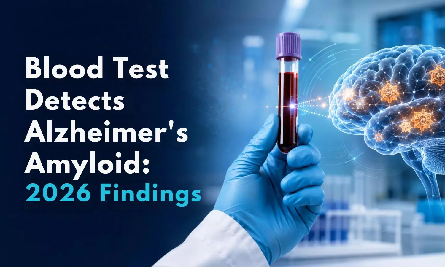 Blood Test Accurately Detects Alzheimers Amyloid Pathology in Symptomatic Adults: Latest 2026 Study Findings